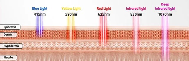 Technical customization including wavelength configuration and firmware development